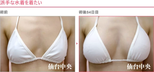 派手な水着を着たい 症例写真