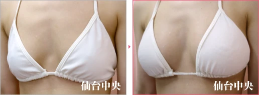 派手な水着を着たい 症例写真3