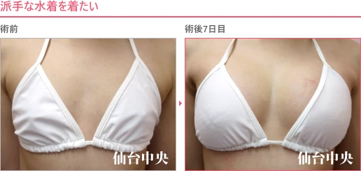 派手な水着を着たい 症例写真