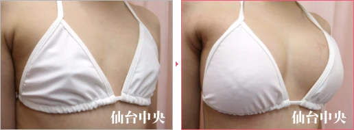 派手な水着を着たい 症例写真2